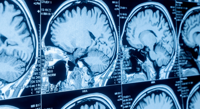 brain scans