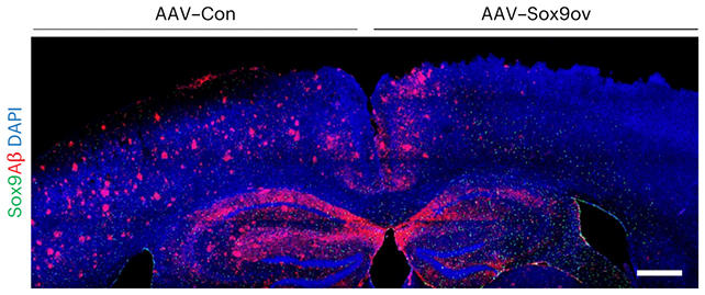 Mouse brain scan