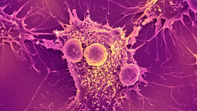 Cancer Vaccine Blocks Multiple Tumors in Mice For 250 Days