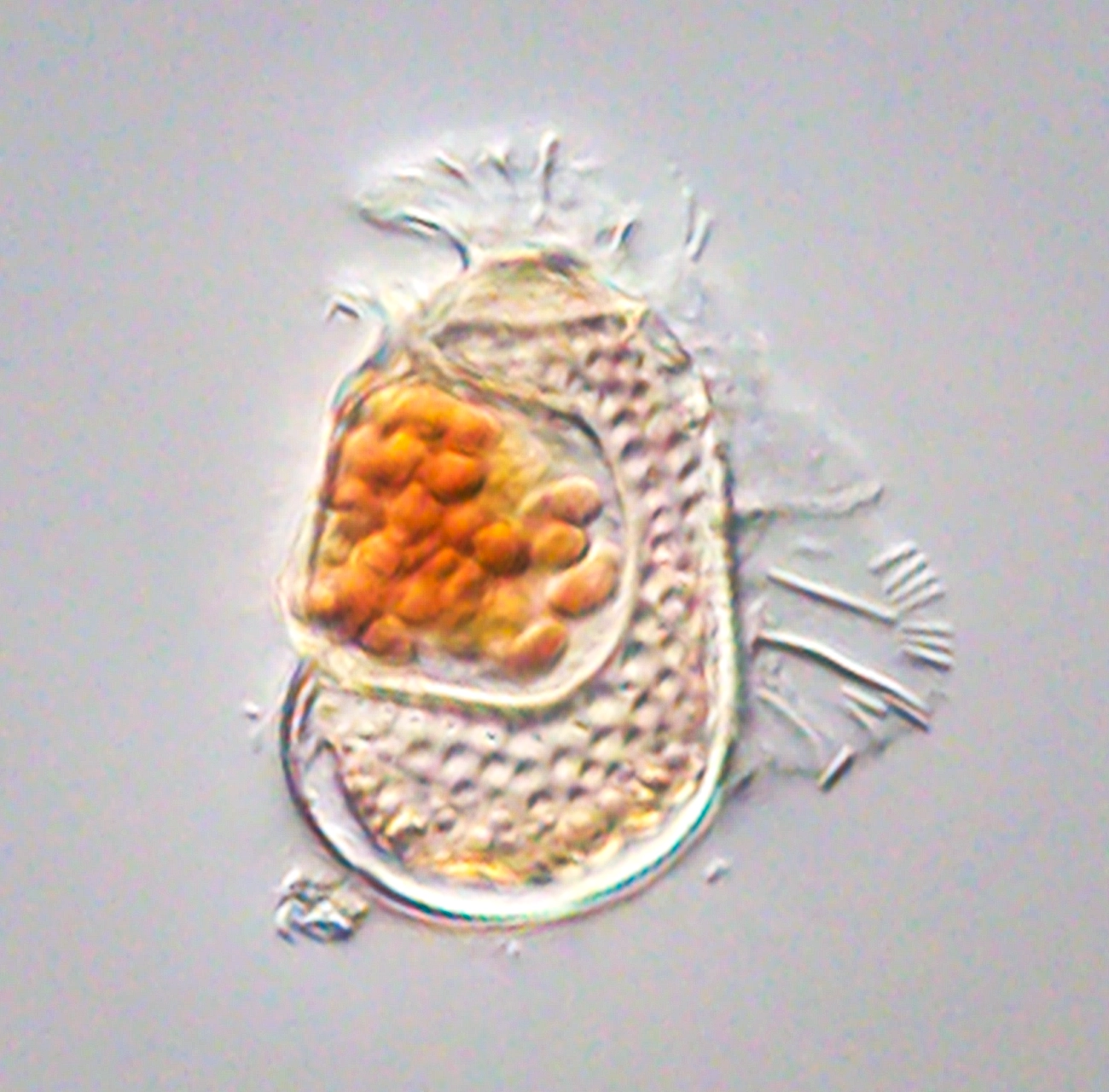 A cell appears to have a mouth, inside of which are spherical orange cells.