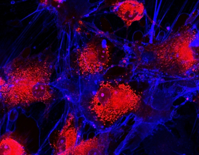 Red cells with blue string-like projections surrounding them