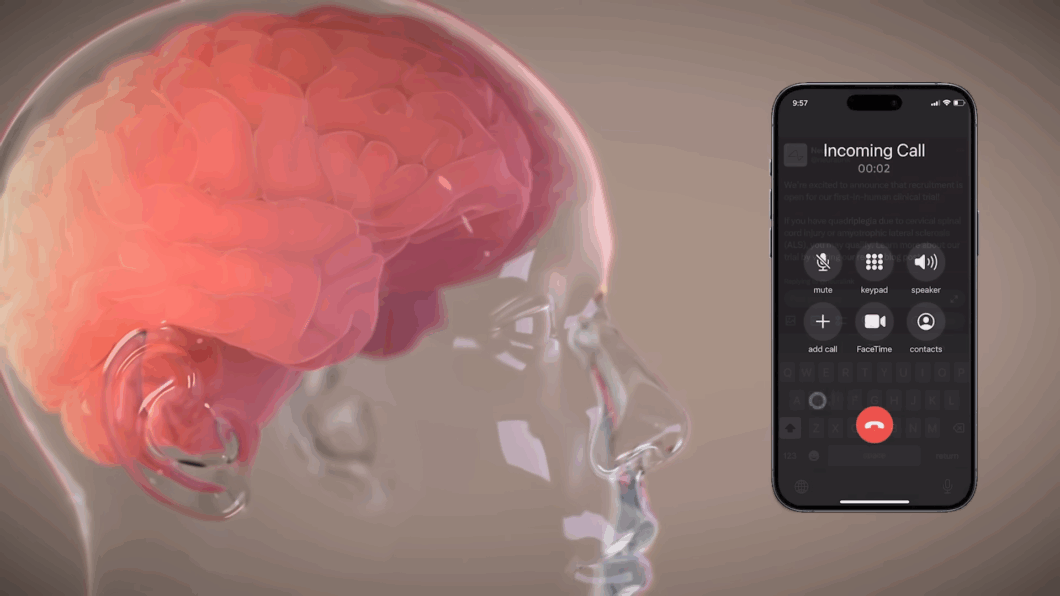 Funcionamento do chip da Neuralink