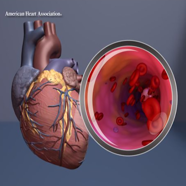 Heart artery graphic