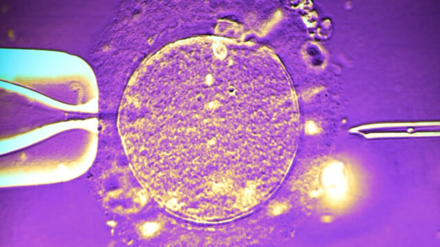 A needle about to inject sperm into an egg in IVF treatment