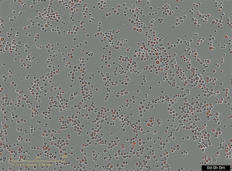 Animation shows, over 5 hours, red dots indicating killed cancer cells.