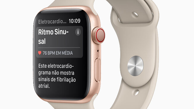 Apple Watch ECG