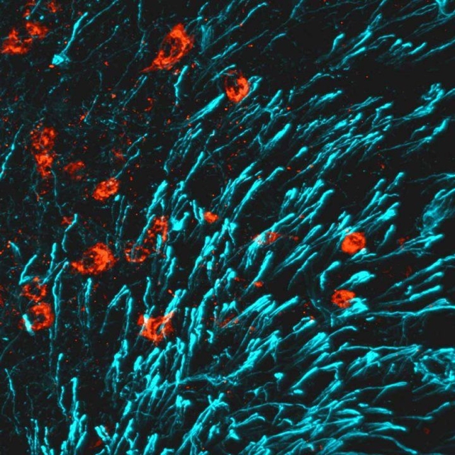 New Breakthrough to Strengthen Bone Could Reverse Osteoporosis