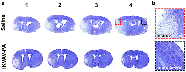 Mouse brain scans