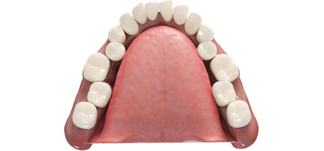 illustration crowded teeth