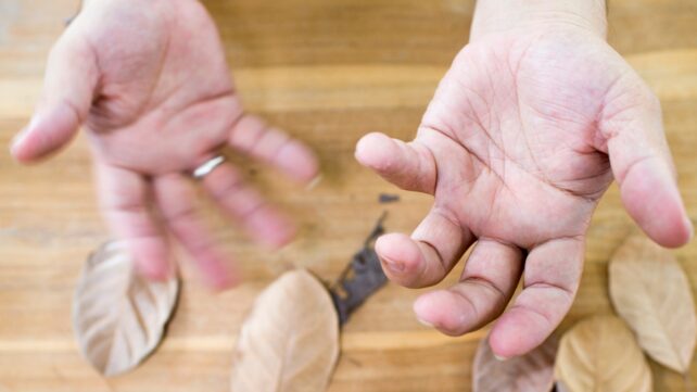 Two trembling hands, with palms facing up