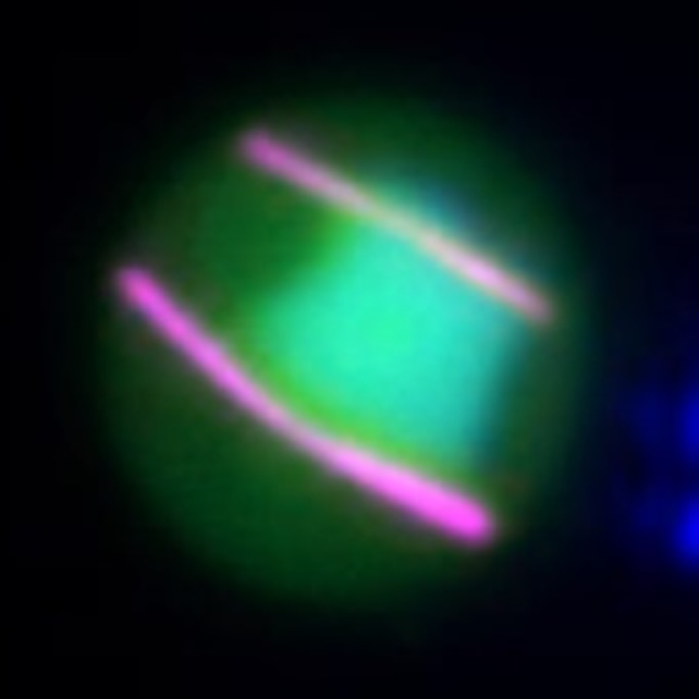 malaria parasite cell with aurora kinases visible