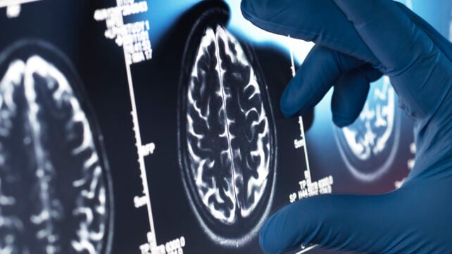 Brain scan slide