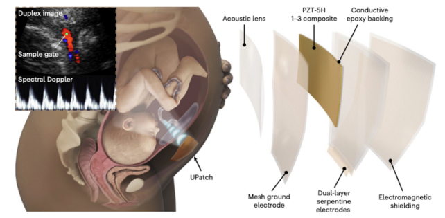 New Ultrasound Patch Could "Transform Pregnancy Care"