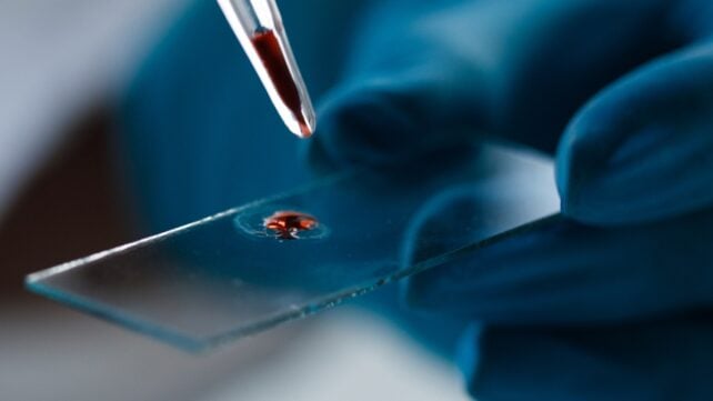 Pipetting a blood drop on a slide