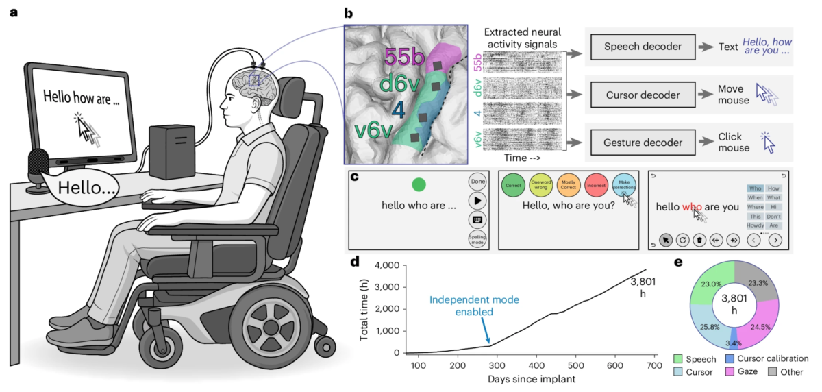 ALS Brain Implant 
