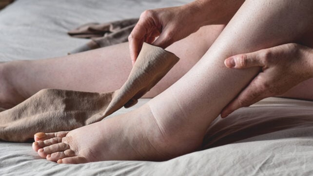 Person putting on compression stockings