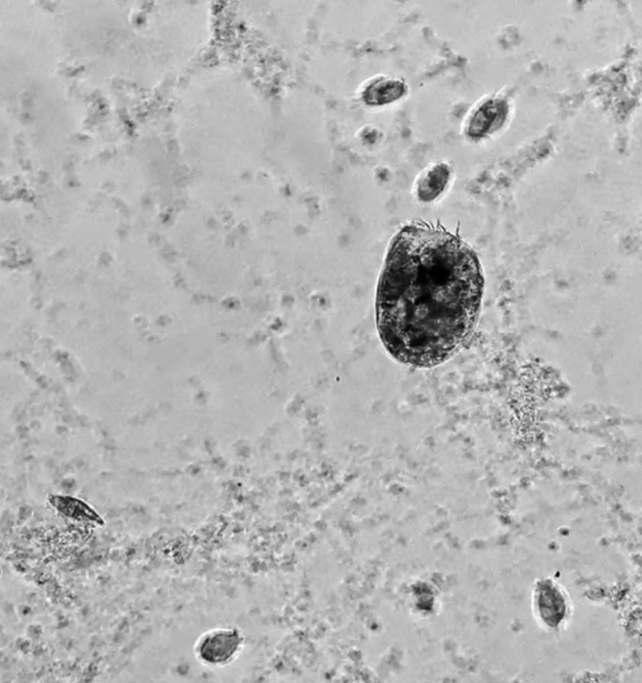 Creepy New Microbe Can Transform Into a Cannibalistic "Supergiant"
