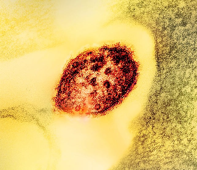 measles virus in red against a yellow background