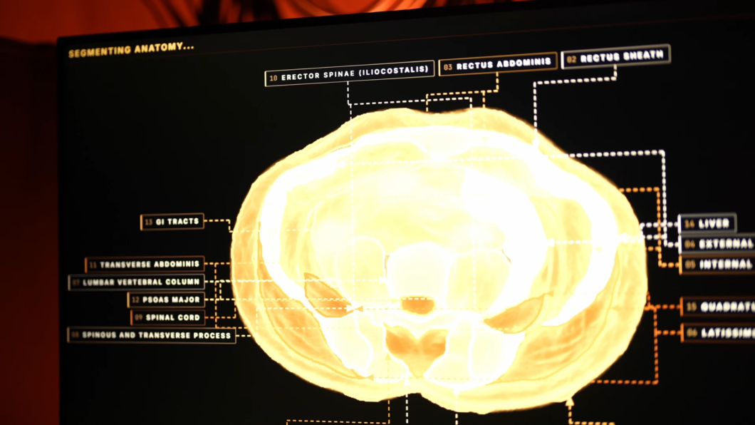 No centro de uma tela preta, destaca-se uma secção transversal do corpo humano, como uma tomografia, que brilha intensamente em tons de amarelo e branco. 