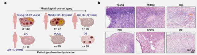 Scientists May Have Found a New Way to Extend Fertility