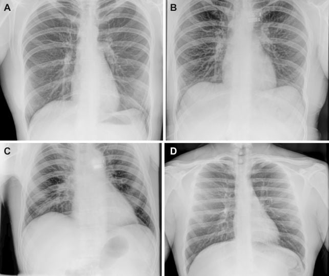Astronauts Have Spent 65 Years Without X-Rays. That's Finally Changing.