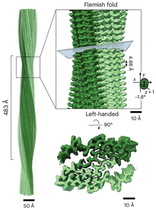Amyloid-beta filaments