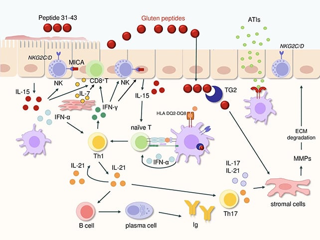 Celiac disease reaction