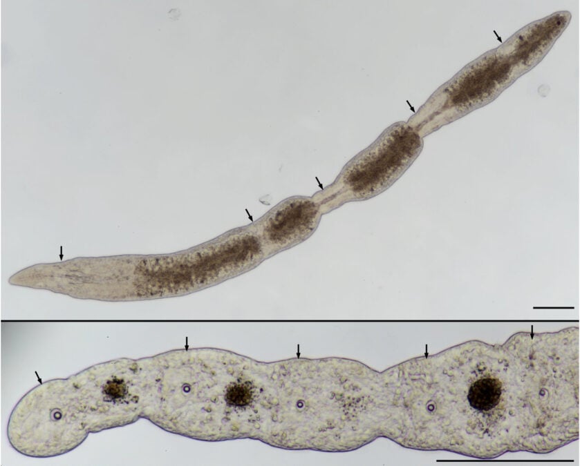 Overfeed This Flatworm And It Turns Into a Chain of Clones