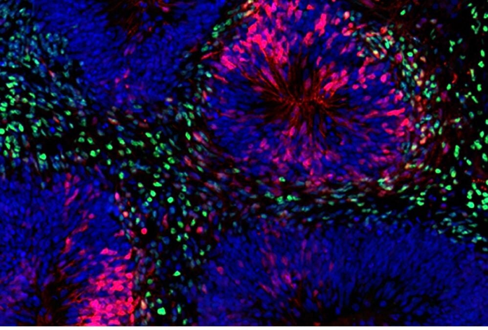 Scientists Built Miniature Brains That Can Experience The Passage Of Time