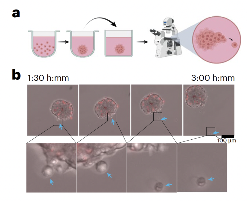 A Common Sugar Helps Cancer Cells Move Around The Body