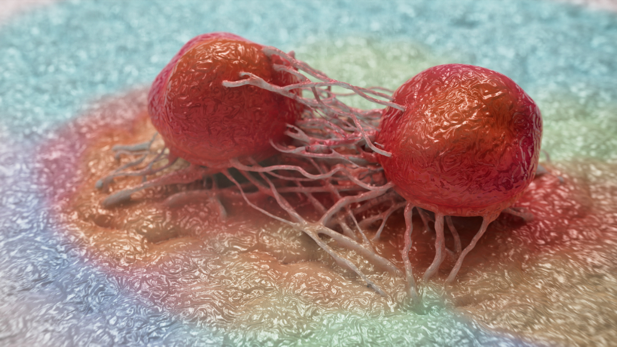Drug Stops 90% of Pancreatic Cancer Migration in Lab Tests