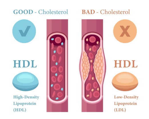 Bad vs Good Cholesterol
