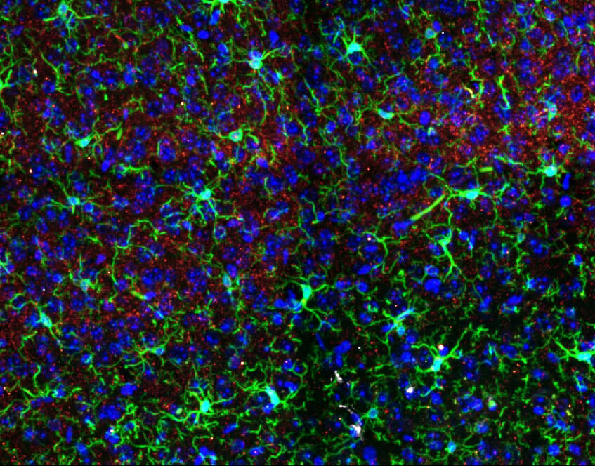 Ketamine Alters Brain Structures – But Only in One Sex, Study in Mice Finds