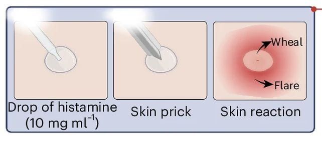 Paying Attention to Your Body Can Actually Change Your Immune Response