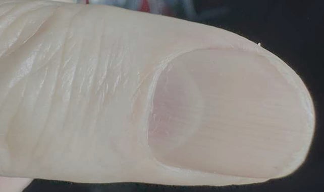 Red fingernail