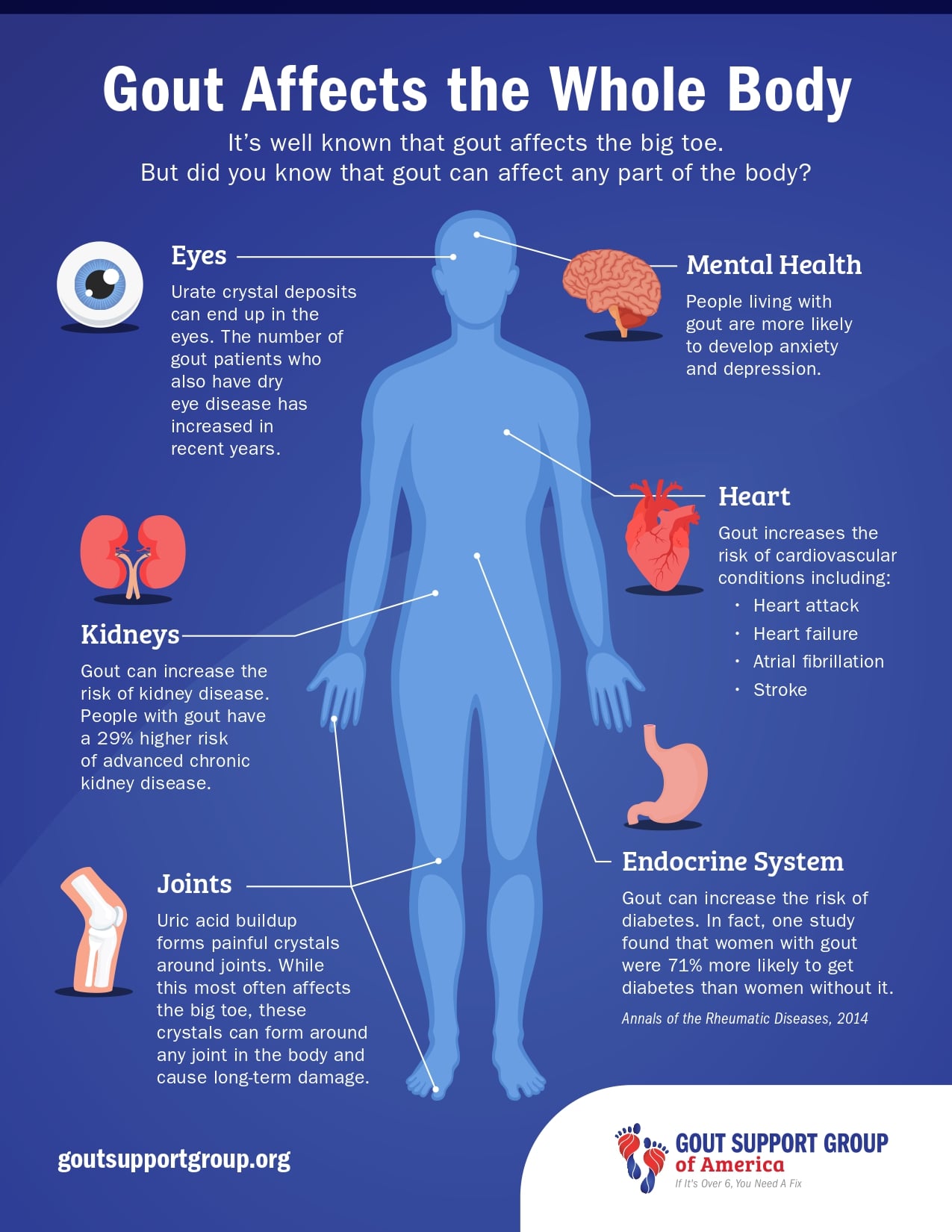 Warning For Men: The Most Common Form of Inflammatory Arthritis May Also Impact Erections