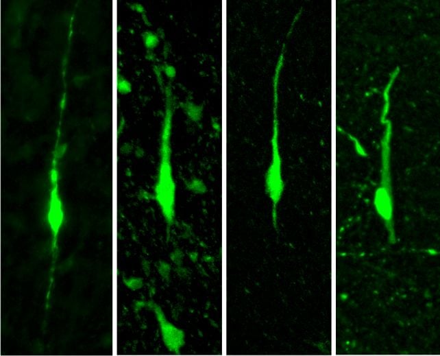 Scientists Replaced Mouse Cortices With Human Brain Tissue. Here's What Happened.