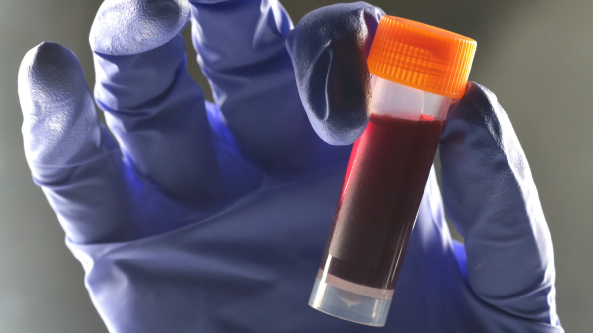 One Blood Type Seems to Carry a Higher Risk of Type 2 Diabetes