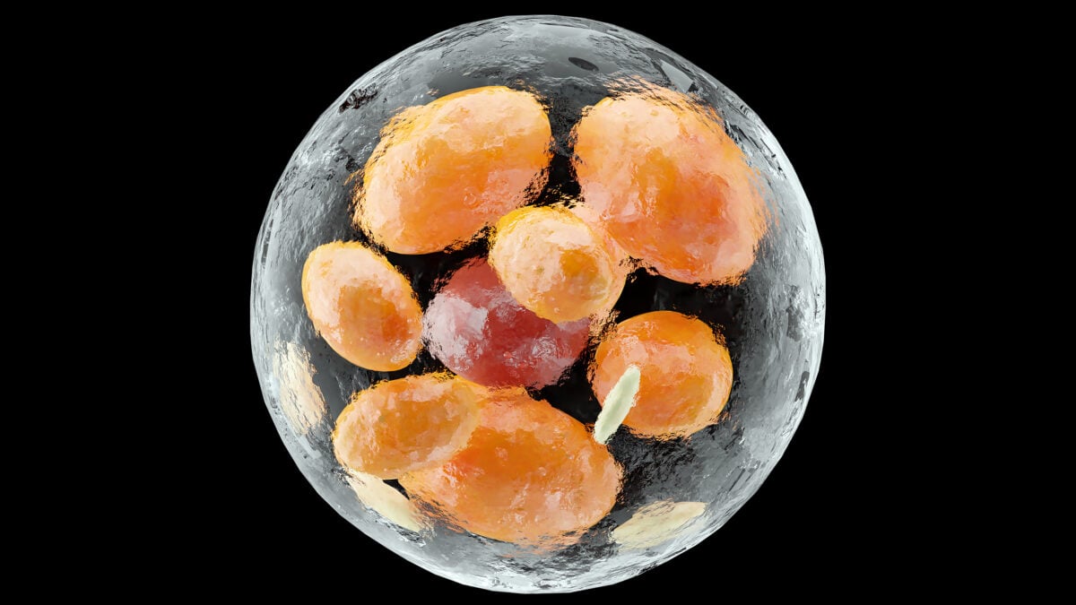 Brown fat cell