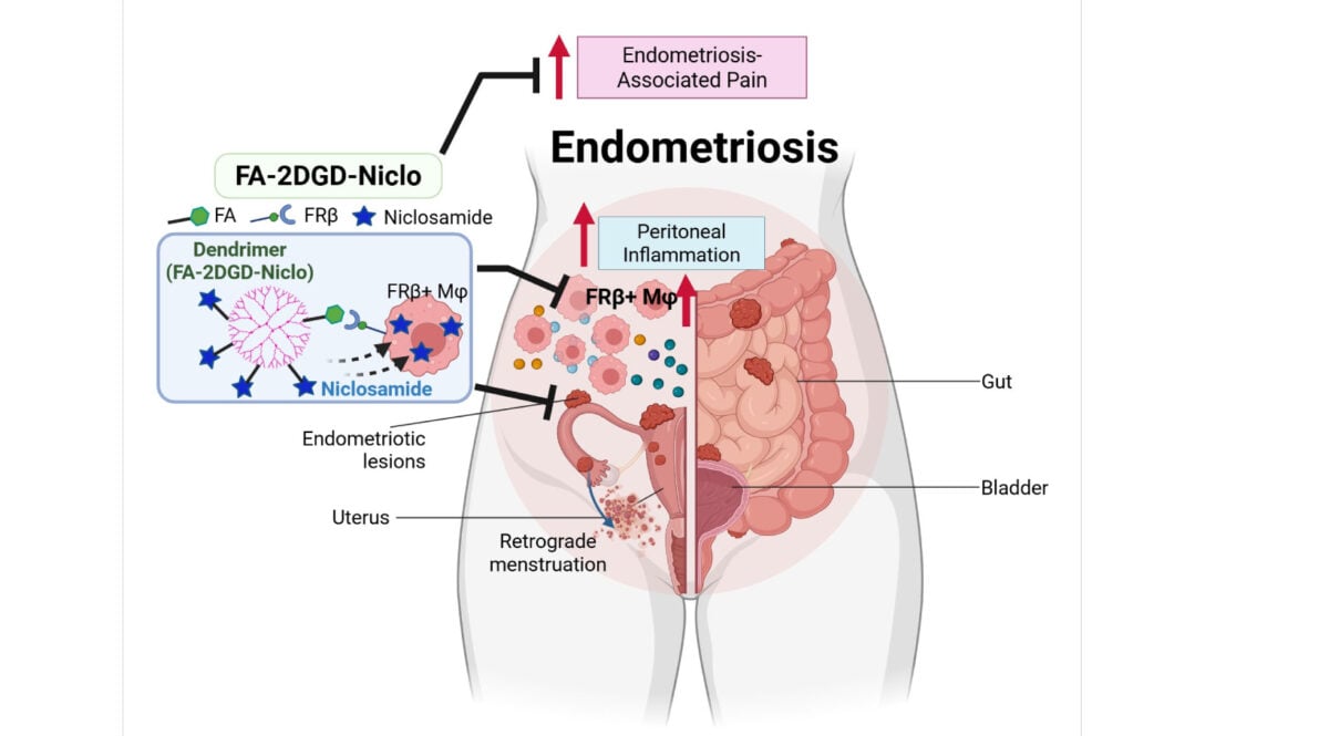 Diagram showing a dendrimer carrying niclosamide into FRβ-positive macrophages associated with endometriosis.
