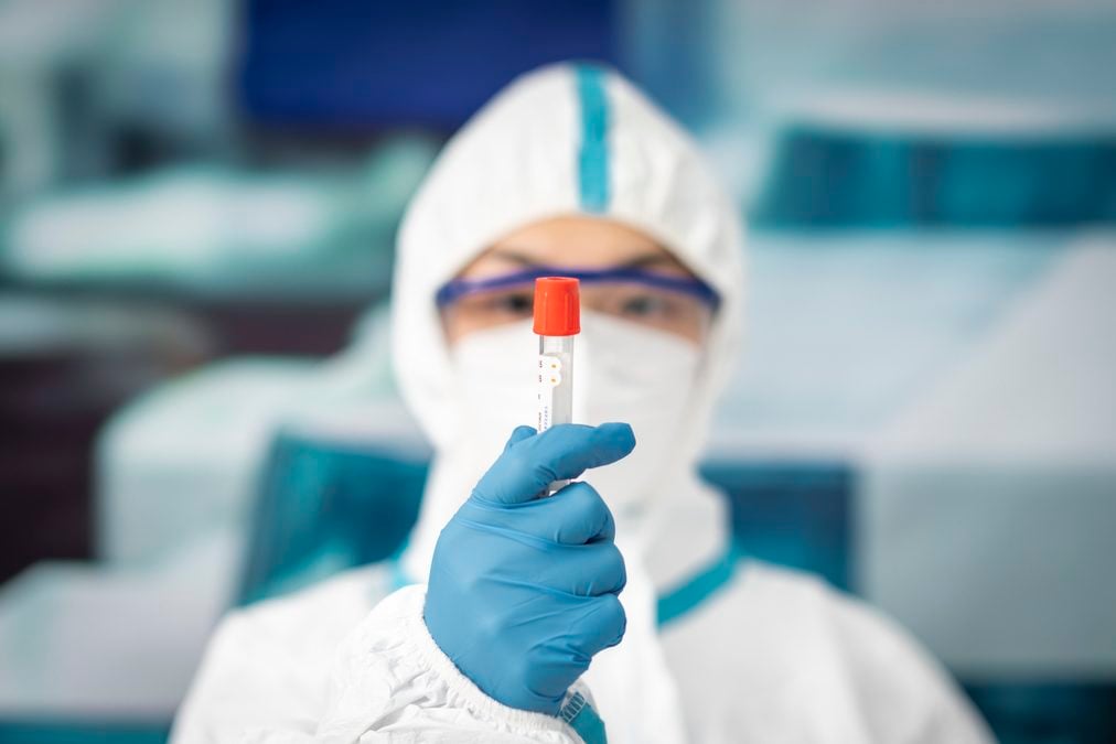 A Russian Lab Worker's Death Has Sparked Plague Fears. Here's What We Know