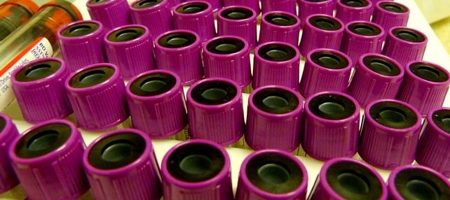 Fasting Before Lab Tests Is Often Unnecessary, Study Suggests